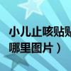小儿止咳贴贴在哪里图片大全（小儿止咳贴贴哪里图片）