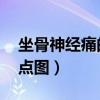 坐骨神经痛的疼点图 位置（坐骨神经痛的疼点图）