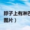 脖子上有淋巴结正常吗图片（脖子上有淋巴结图片）