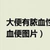 大便有脓血性粘液是什么原因（脓血便和粘液血便图片）
