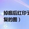 掉痂后红印子淡化过程图片（掉痂后红印子恢复的图）