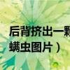 后背挤出一颗黑色硬米粒图片（后背挤出来的螨虫图片）