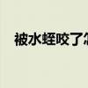 被水蛭咬了怎么办?（被水蛭咬了怎么办）