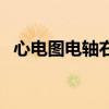 心电图电轴右偏怎么看（心电图电轴右偏）