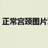 正常宫颈图片对比（正常的宫颈图是什么样）