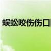 蜈蚣咬伤伤口图片大全（蜈蚣咬伤伤口图片）