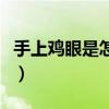 手上鸡眼是怎么根治（手上鸡眼图片挖出图片）