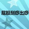 屁股刮痧出痧说明什么（刮痧出痧说明什么）