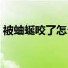 被蚰蜒咬了怎么办图片（被蚰蜒咬了怎么办）