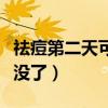祛痘第二天可以敷面膜吗（祛痘方法第二天就没了）