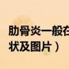 肋骨炎一般在哪个位置痛图片（肋软骨炎的症状及图片）