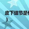 皮下结节是什么意思?（皮下结节是什么东西）