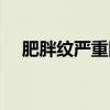 肥胖纹严重图片大全（肥胖纹严重图片）