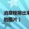 消糜栓排出来的东西是什么（消糜栓排出异物的图片）