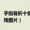 手指骨折十级伤残鉴定标准（手指骨折十级伤残图片）