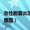 急性胆囊炎怎么缓解疼痛（女性胆囊炎疼痛位置图）