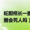 蛇胆疮长一圈能缠死人是真的吗（蛇胆疮长一圈会死人吗）