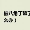 被八角丁蛰了用什么药止痛（被八角丁咬了怎么办）
