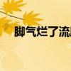 脚气烂了流脓（脚气溃烂流黄水怎么治）