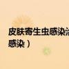 皮肤寄生虫感染治疗药的禁忌症叙述错误的是（皮肤寄生虫感染）