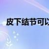 皮下结节可以治愈吗（皮下结节有危害吗）