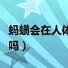 蚂蟥会在人体内繁殖吗（蚂蝗进入人体还能活吗）