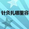 针灸扎哪里容易瘫痪（针灸会把人扎瘫痪吗）