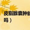 皮脂腺囊肿能自行消退吗(皮脂腺囊肿可以挤吗) 皮脂腺囊肿能自行消退吗(皮脂腺囊肿可以挤吗)