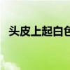 头皮上起白色的皮（头皮起白色的皮图片）