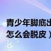 青少年脚底出汗什么原因造成的（青少年足底怎么会脱皮）