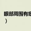 眼部周围有细纹该怎么办（眼周围细纹怎么去）