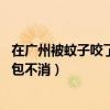 在广州被蚊子咬了很多包 用什么药好（广州的蚊子咬过很痒包不消）