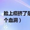 脸上痘挤了是个血洞怎么修复(脸上痘挤了是个血洞) 脸上痘挤了是个血洞怎么修复(脸上痘挤了是个血洞)