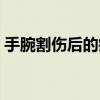 手腕割伤后的疤痕图片（手上的大动脉在哪）