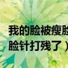 我的脸被瘦脸针打残了会怎么样（我的脸被瘦脸针打残了）