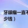 牙龈瘤一直不切有害处吗（牙龈瘤手术一般多少钱）