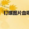 钉螺图片血吸虫（钉螺吃了会得血吸虫吗）