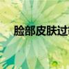 脸部皮肤过敏能吃鱼吗(过敏能吃鱼吗) 脸部皮肤过敏能吃鱼吗(过敏能吃鱼吗)
