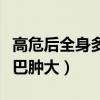 高危后全身多处淋巴结疼痛（高危后多久会淋巴肿大）