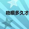 吻痕多久才能消失（吻痕多久才会消失）