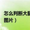 怎么判断大腿浮肿图片女（怎么判断大腿浮肿图片）