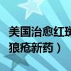 美国治愈红斑狼疮新药倍力腾（美国治愈红斑狼疮新药）