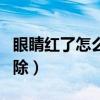 眼睛红了怎么快速消红（眼睛红了怎么快速消除）