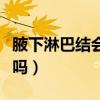 腋下淋巴结会自己消吗（腋下淋巴结会自己好吗）