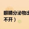 眼睛分泌物出不来怎么办(眼睛分泌物增多睁不开) 眼睛分泌物出不来怎么办(眼睛分泌物增多睁不开)