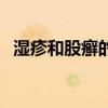湿疹和股癣的区别（湿疹和癣的区别图片）