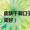 皮肤干裂口子用什么药膏(皮肤干裂用什么药膏好) 皮肤干裂口子用什么药膏(皮肤干裂用什么药膏好)