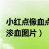 小红点像血点不痛不痒特别小（胳膊小红点像渗血图片）