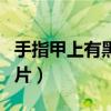 手指甲上有黑线图片大全（手指甲上有黑线图片）