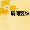 眉间竖纹的眉间纹详解（眉间竖纹）